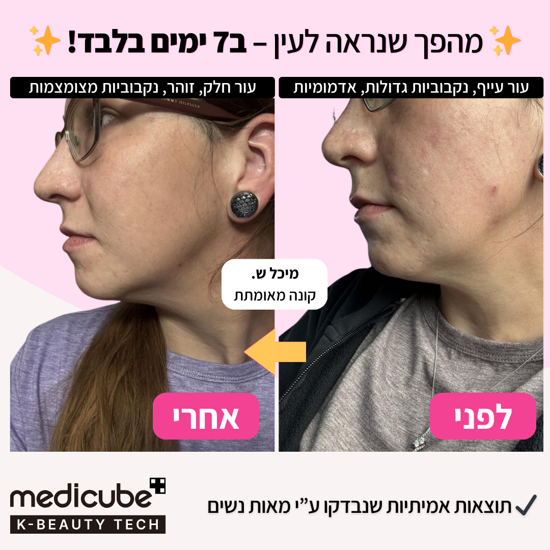 Medicube® Pink Collagen Glow Cream | קרם קולגן ורוד להחזרת הזוהר והמתח לעור